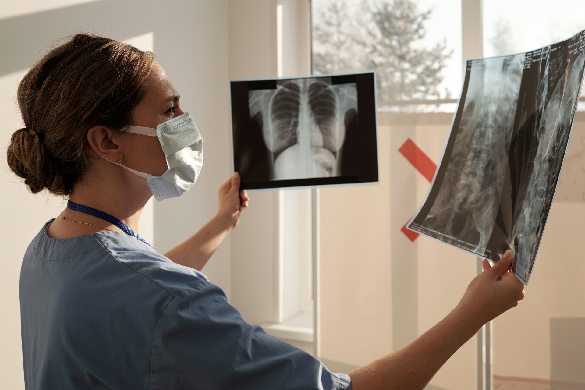 X Ray